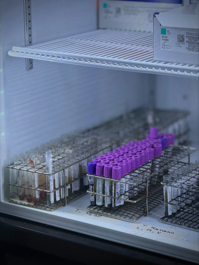 Tubos de muestra para análisis sanguíneo