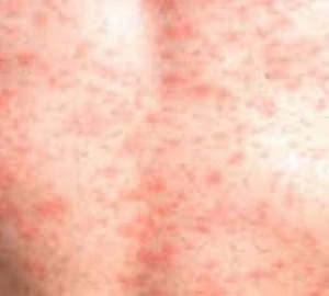 Paciente femenina de 24 años